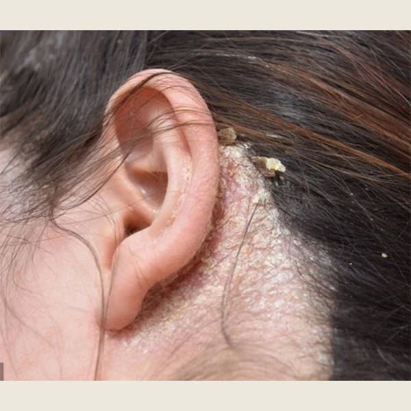 去头皮屑比较好的洗发水有哪些?男士去屑去油效果最好的洗发水推荐