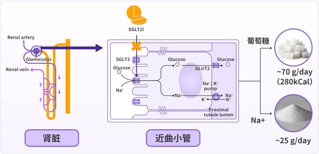 sglt2 對葡萄糖,鈉的跨膜轉運,進而減少腎臟近曲小管鈉葡萄糖重吸收