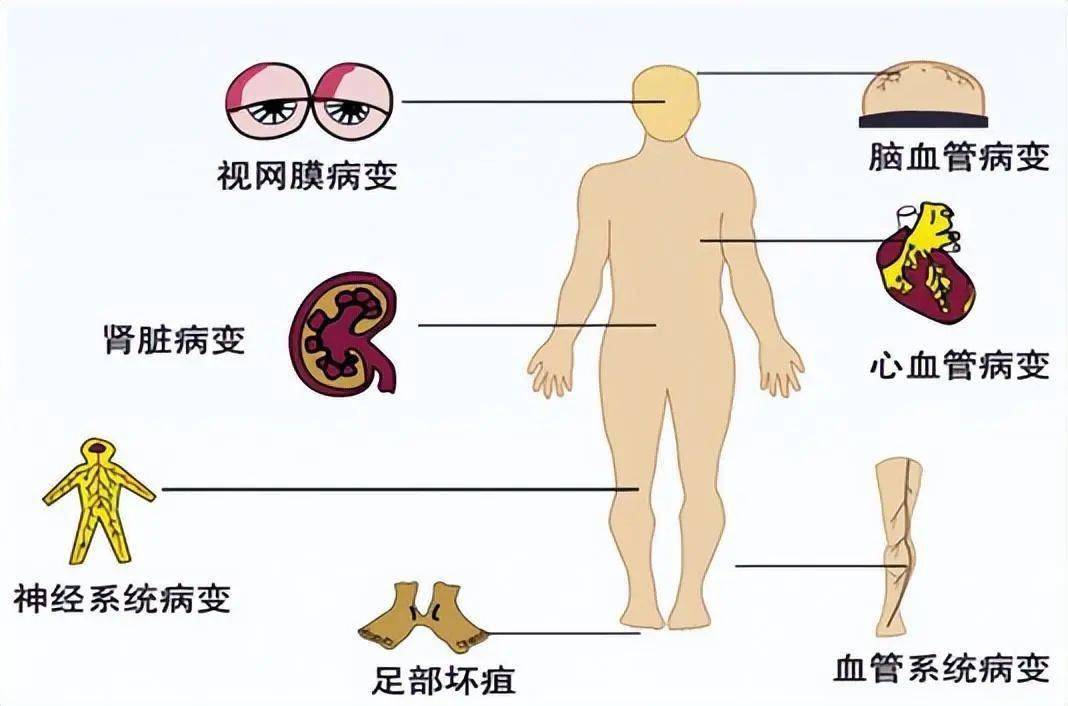 68歲男子因血糖過高死亡,再次提醒:這3種素食,糖友要