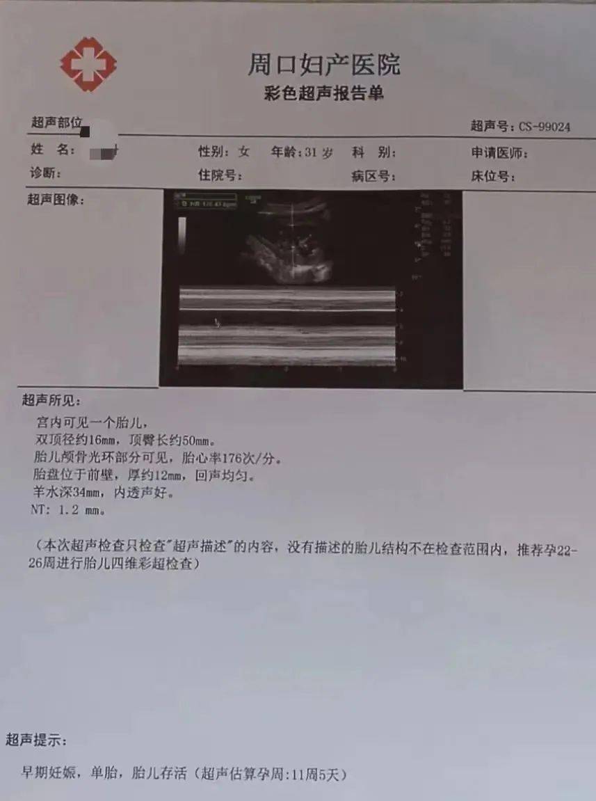 怀孕超声诊断报告单图片