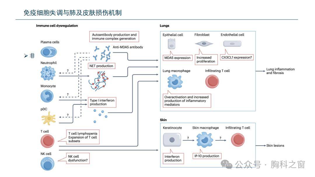 抗mda5抗體陽性皮肌炎的發病機制及臨床進展_患者