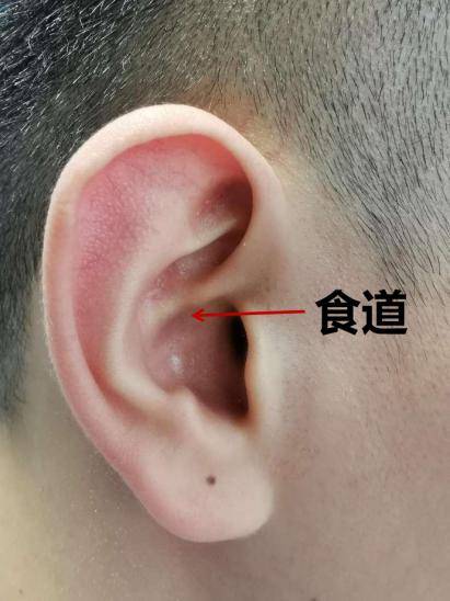 食道穴:位于耳甲腔,耳轮脚下方中1/3处