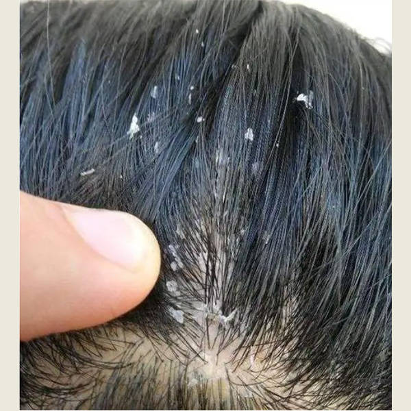 中国口碑最好的洗发水_头皮_头发