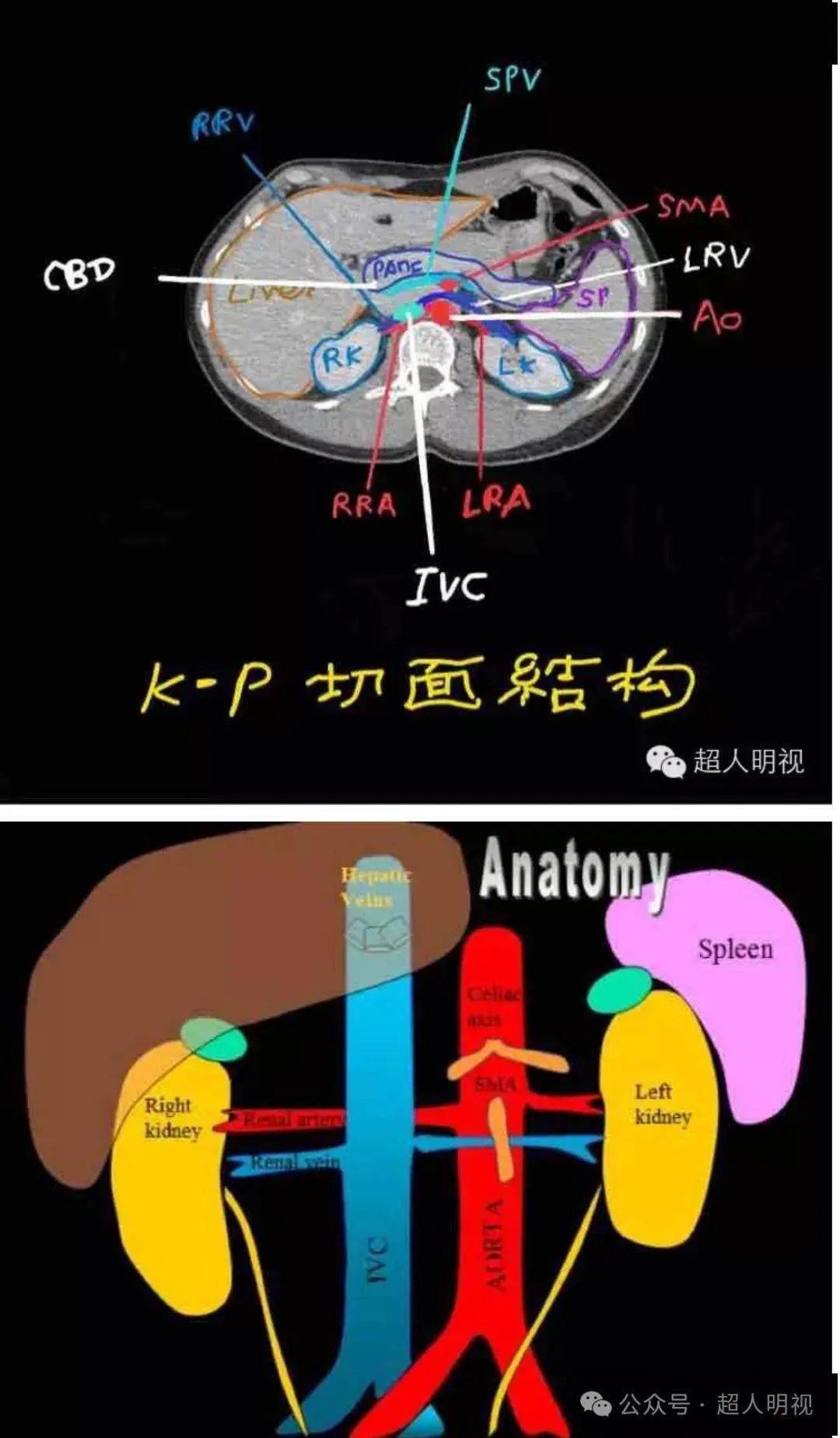 k-p切面很重要_动脉_右肾_静脉