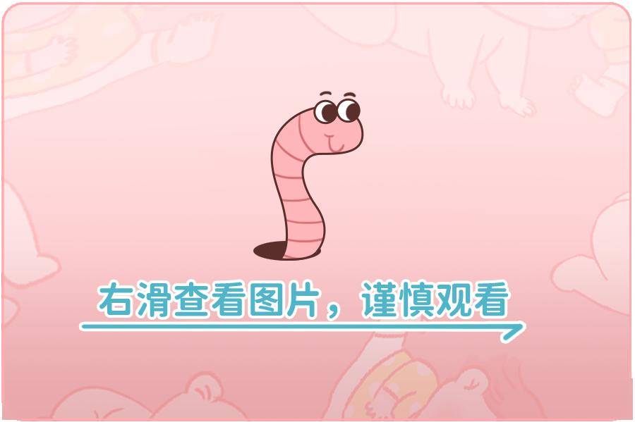 男孩便便拉出活虫,竟然还在疯狂产卵!