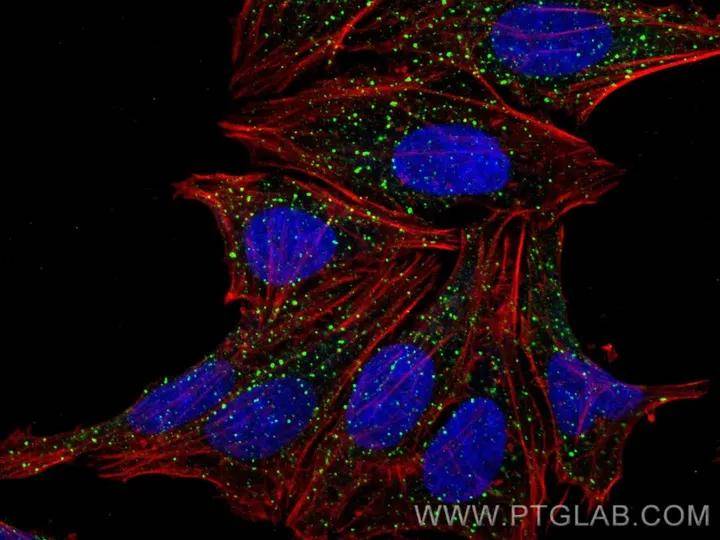 marker_蛋白_高尔基体