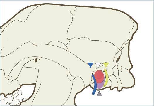 外科实用技术图谱:12张图片 视频详解犬全耳道切除术_区域_解剖_进行