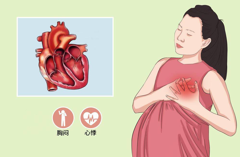 关于妊娠期心脏病,你了解吗?_心功能_孕妇_情况