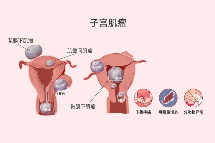 医院让人脸红的妇科检查,没有性生活要做吗