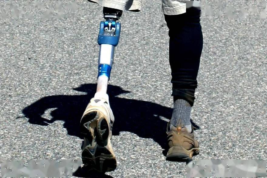 瑞士研发出新型仿生义肢,帮助截肢者更好地感知地面_信号_研究人员