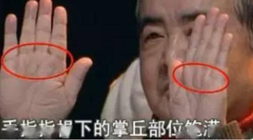 这条糖尿病线,你手上有没有?_刮痧_穴位_手掌