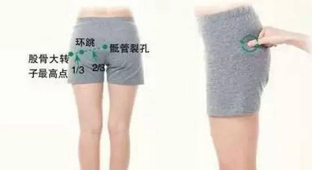 臀小肌,梨状肌,还是臀肌筋膜,坐骨神经,闭孔内肌与上下孖肌,都不能