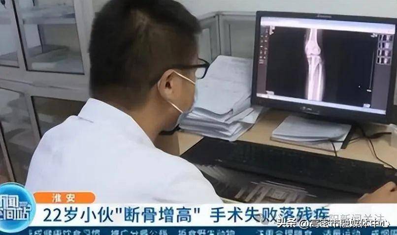 2014年,20岁北京男孩李亚诺,花16万断骨增高7.