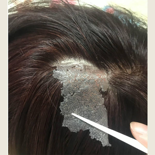 秋季有头皮屑用什么样的洗发水?_头发_去屑_成分