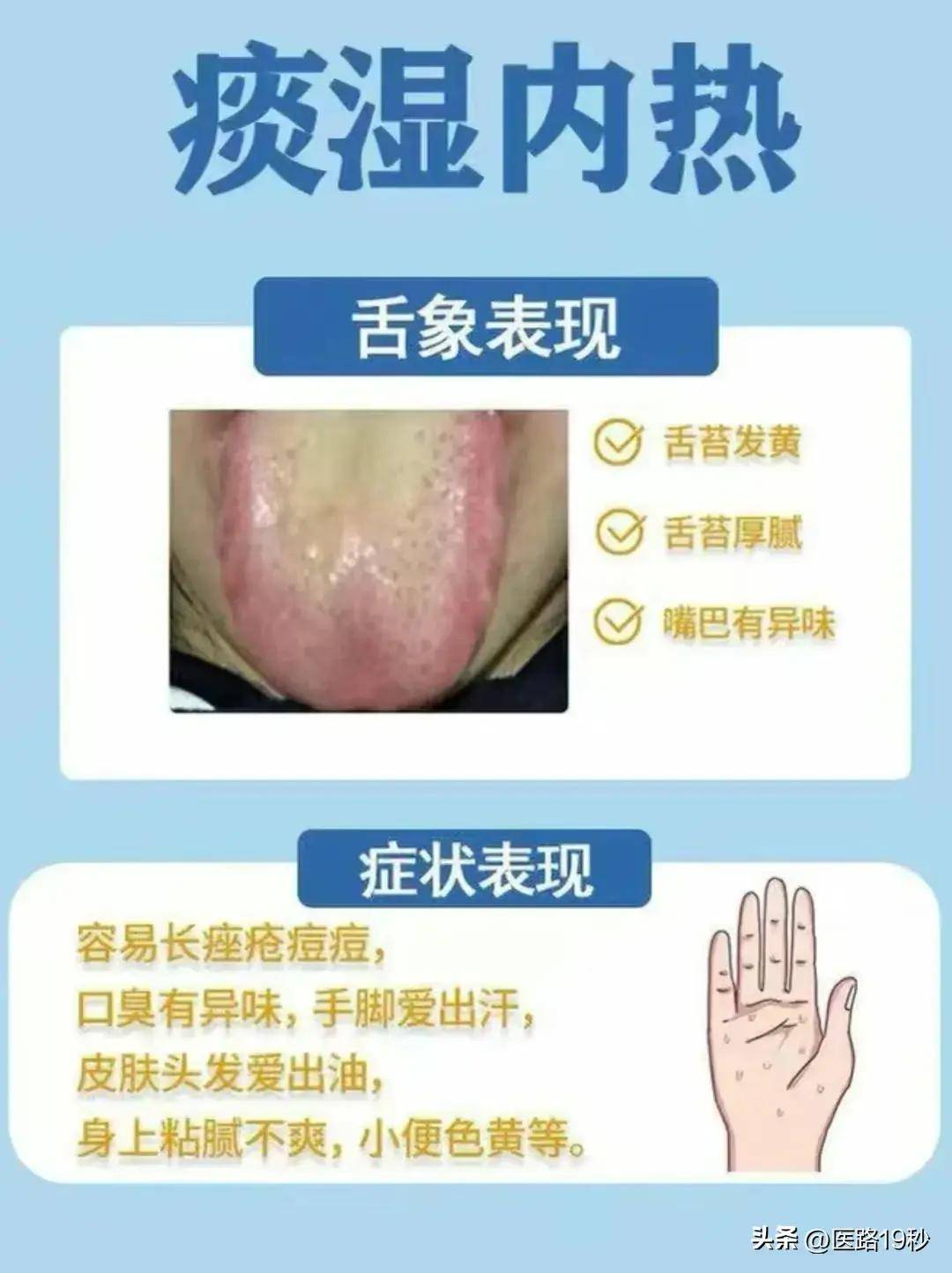 舌苔就是最好的体检报告,一般不会作假!