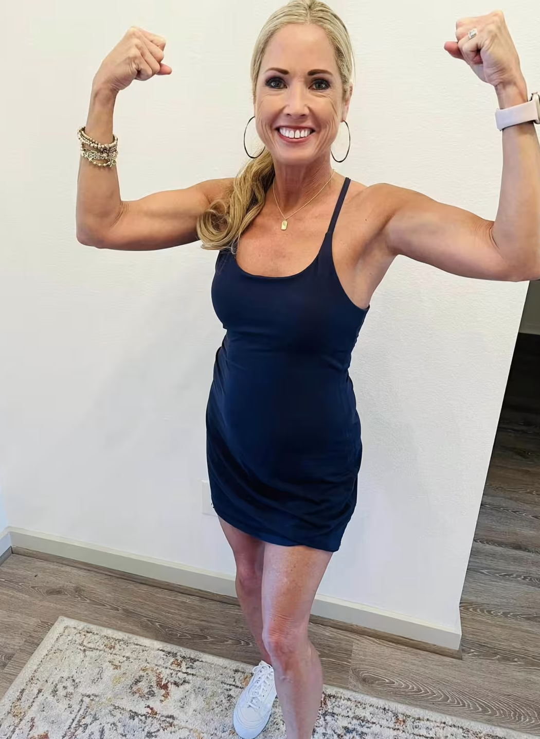 美国女教师感冒发烧后,四肢变黑被迫截肢:现在只想快乐活着_雪莉·