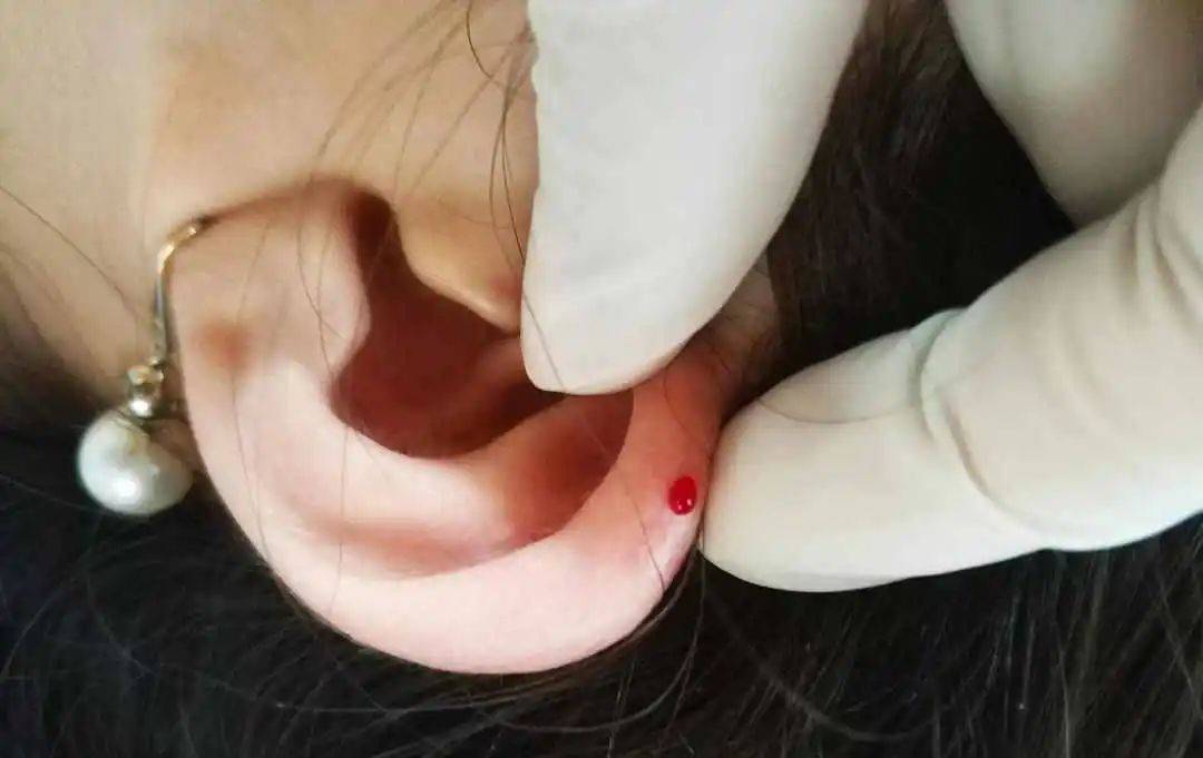 文明健康科普 | 树立主动健康意识,科学爱耳护耳