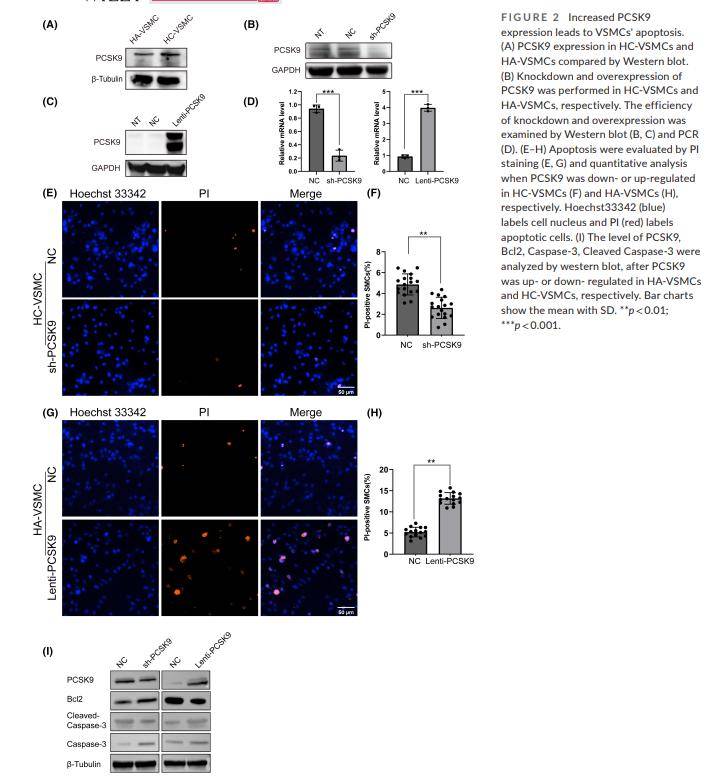 pcsk9通过诱导血管平滑肌细胞的线粒体功能异常和凋亡而增加颈动脉