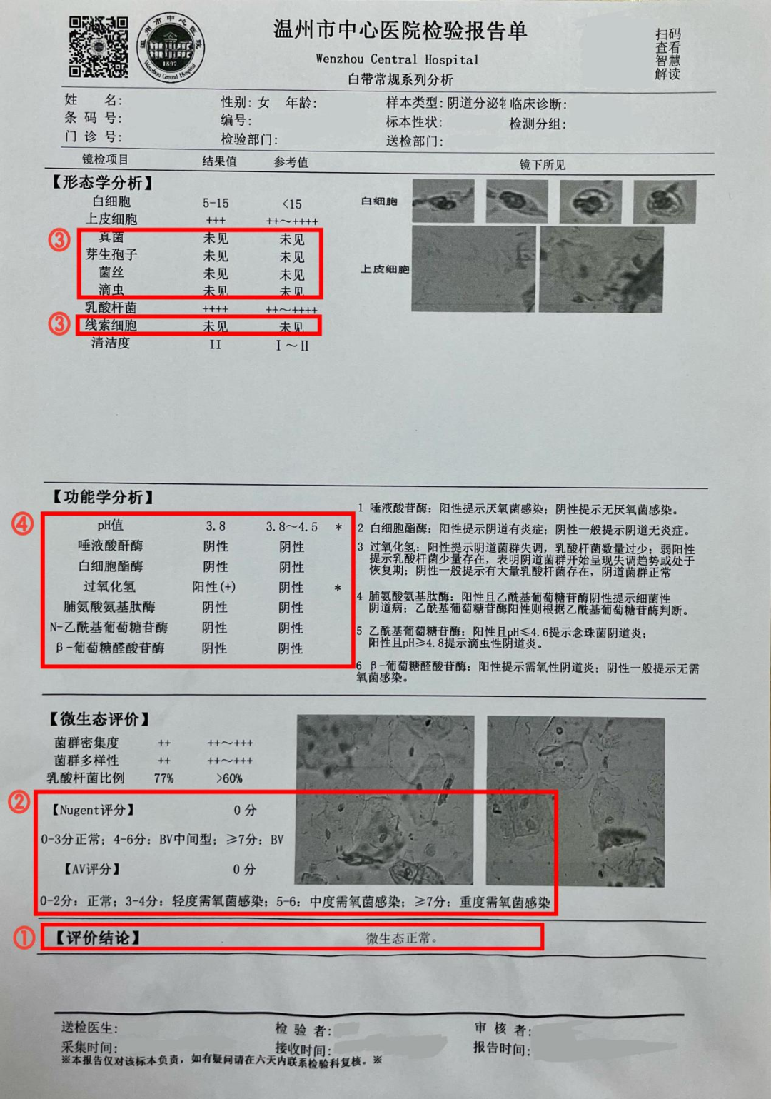 阴道微生态检查报告单解读 一旦出现外阴瘙痒或烧灼感