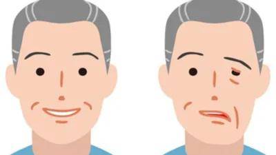 可能存在健康问题_耳垂_皮肤_血管