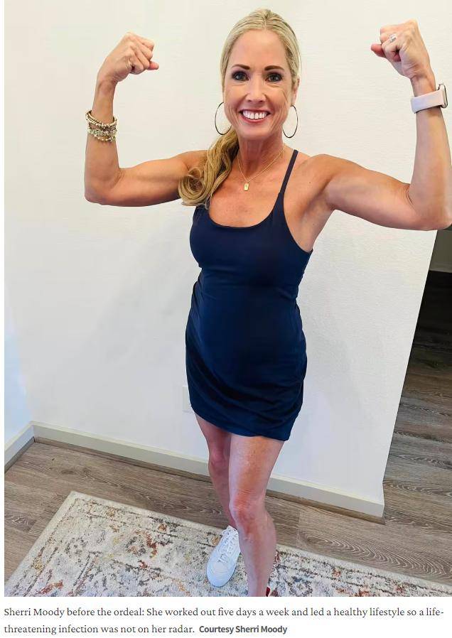 这种细菌24小时内可夺命_雪莉_大卫_医生