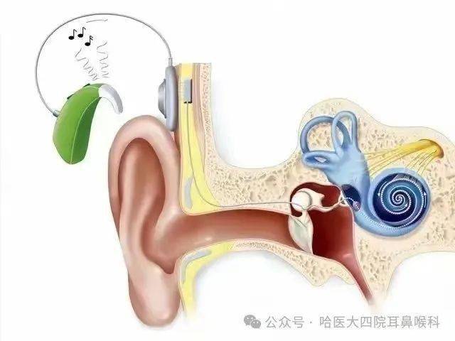 发挥科技优势为全民畅听赋能