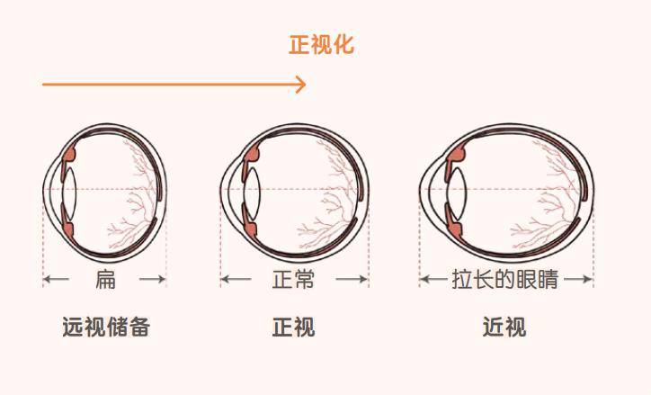 儿童近视防控的关键数值