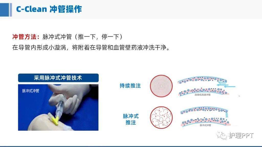 双腔cvc管的结构图图片