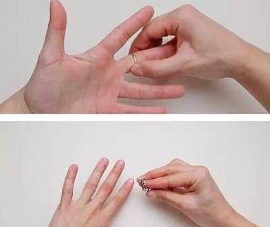 一男子"魔戒"卡手现肿胀 求助消防队_戒指_手指_处置