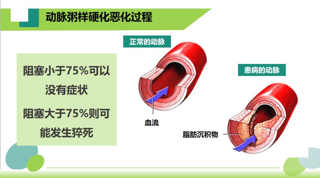 血管堵塞的异常信号