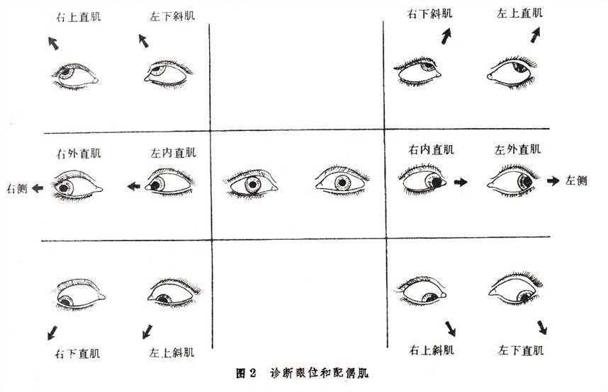 斜视的基本检查法_手机搜狐网