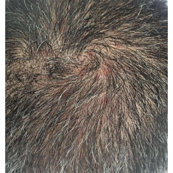 二硫化硒洗发水比较好是什么牌子