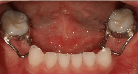 口臭洁牙老年口腔中医口腔门诊即将开诊雁江区人民医院呵护您的牙齿