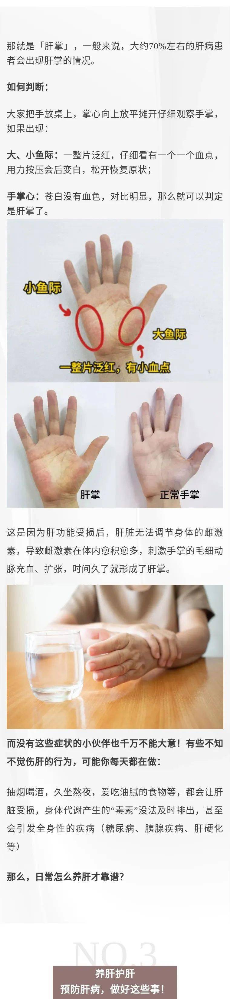 手上有这1个变化,小心是肝癌预警!男女都要警惕