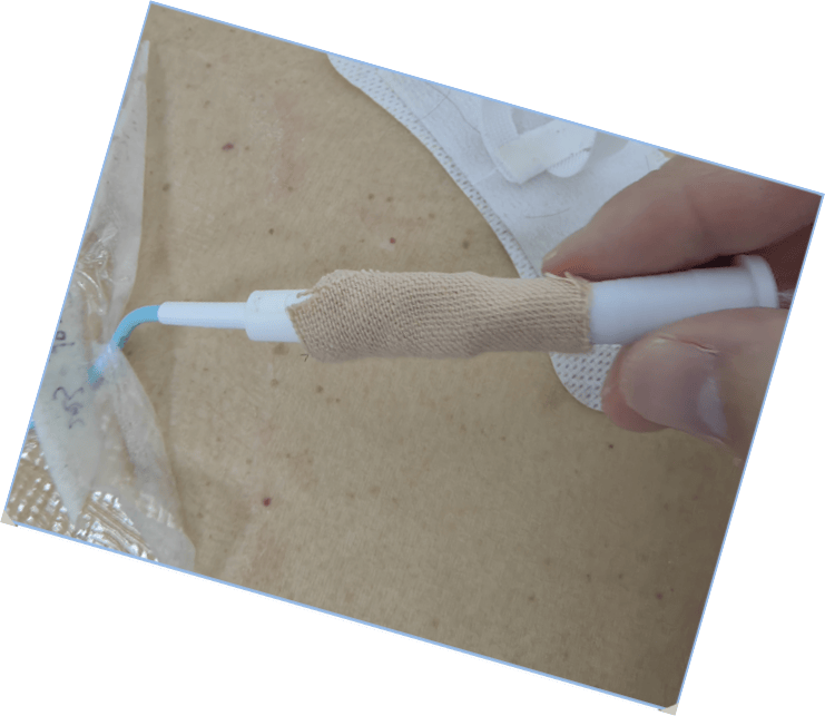 管注细节手护有道科室ptcd管道规范化管理经验分享