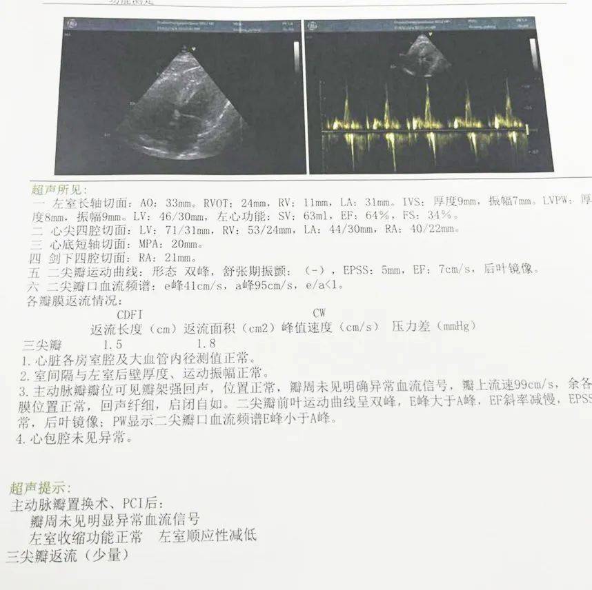 超声心动图:既往史:过去体质身体一般