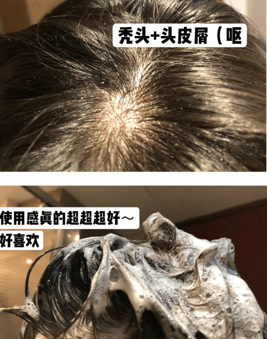 二硫化硒洗发水适用人群清爽的洗发水推荐