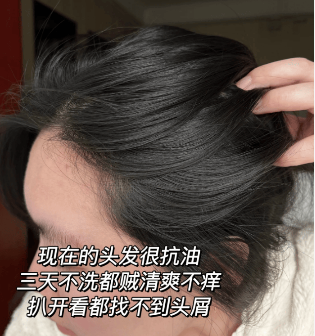 男生洗发水推荐_头发_问题_去屑