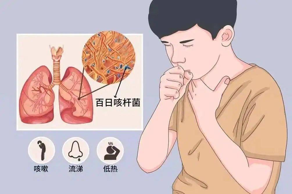 你的口罩呢快戴上