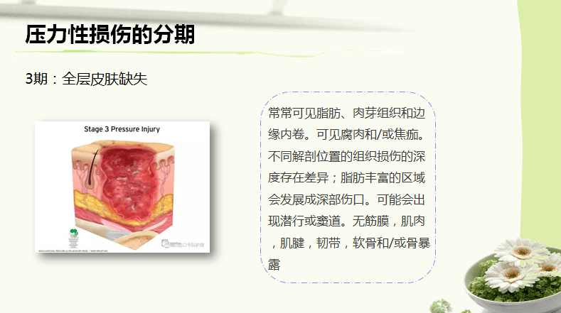 最新版压力性损伤的分期及护理