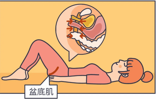 盆底升级之路宝妈们该知道的几个问题
