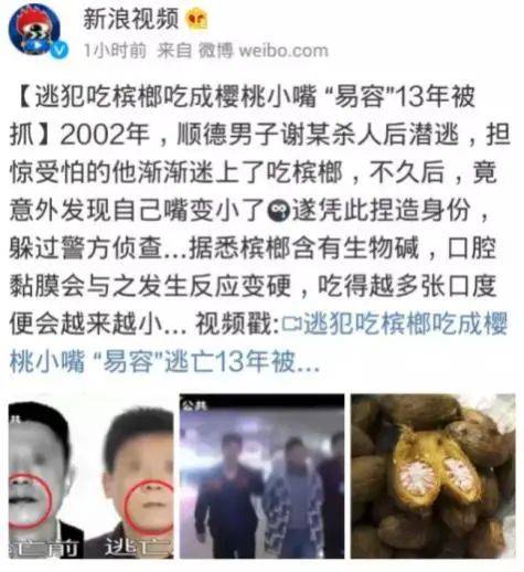 严重磨损,加上槟榔碱,石灰对牙周组织的刺激变黑变黄,大动作的咀嚼