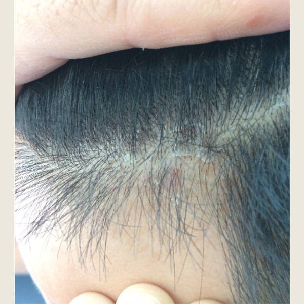 男士去屑防脱洗发水排行_头皮屑_问题_头发