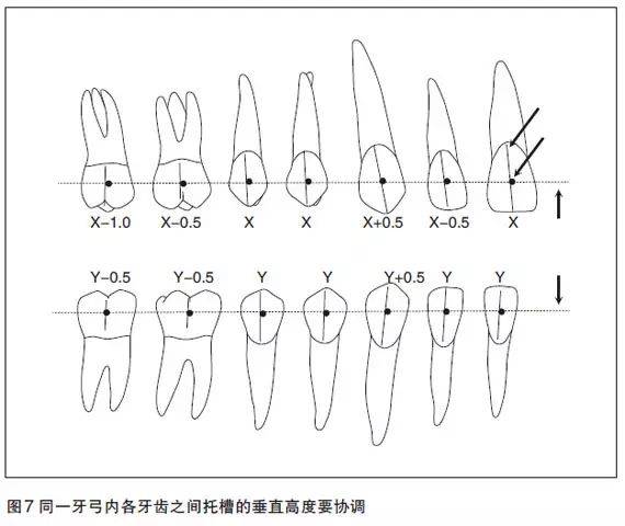 自锁托槽临床应用的技术要点_矫治_患者_damon