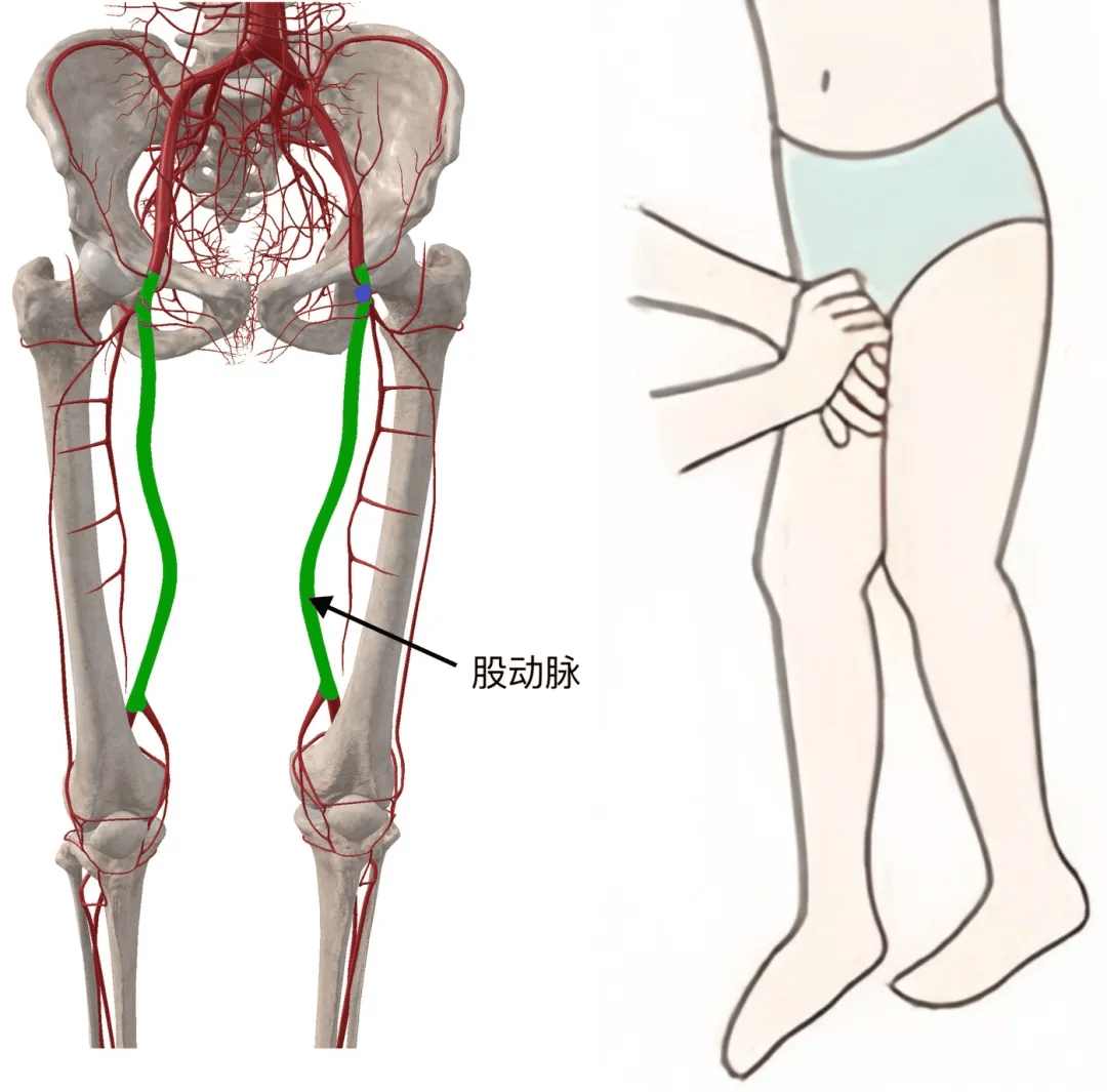 动脉_体表_压迫