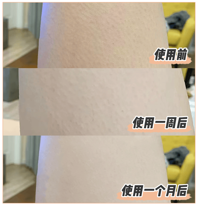 夏天穿什么都不好看因为你这里没做对啊