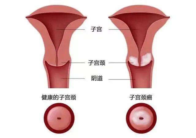 高阳县医疗卫生集团61妇幼保健院 全国肿瘤防治宣传周