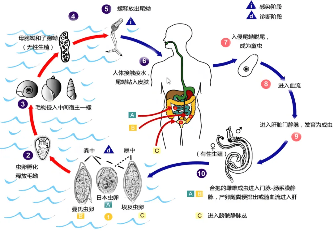 近期开始高发,接触10秒即可被感染!_血吸虫_尾蚴_症状