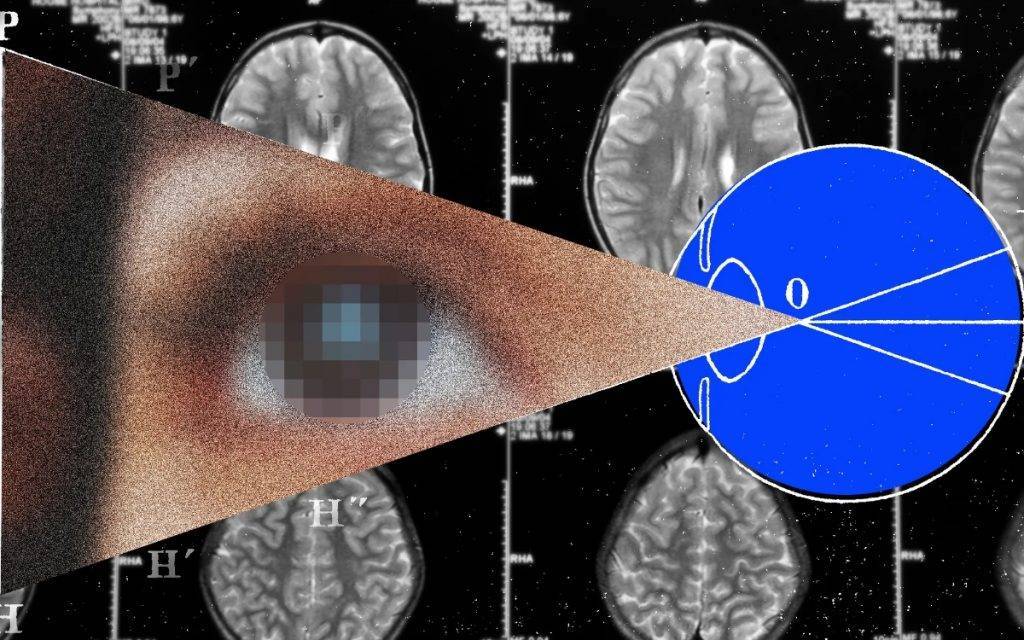 马斯克会如何让盲人重见光明
