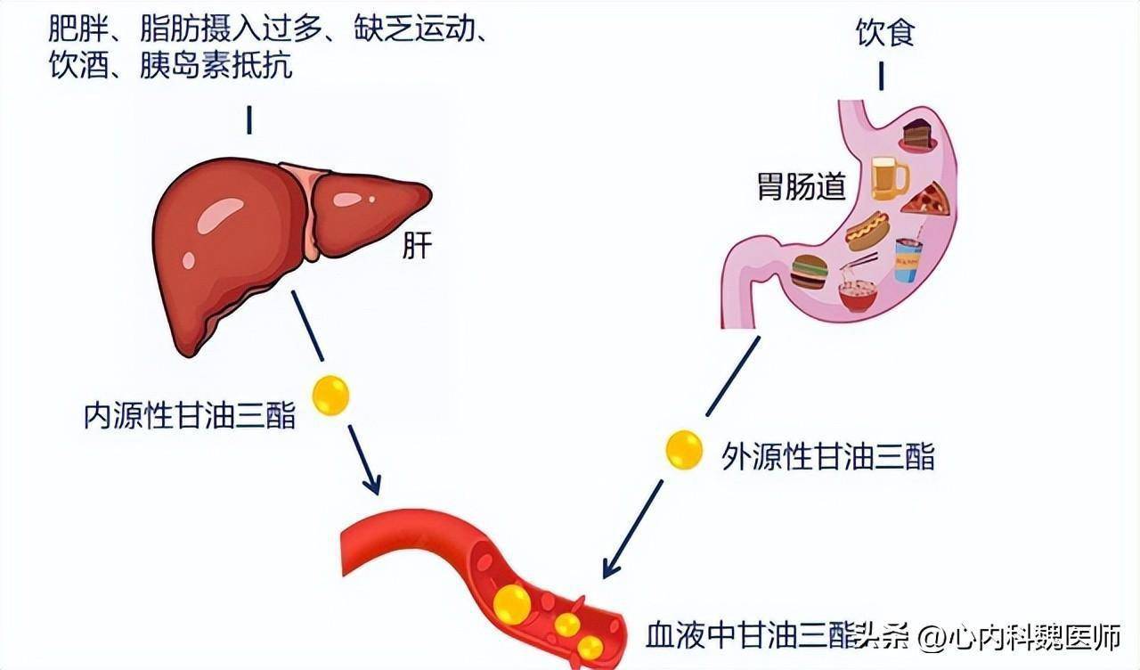 甘油三酯大户被揪出提醒55岁后这3类食物尽早忌口